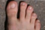 puces9710.jpg